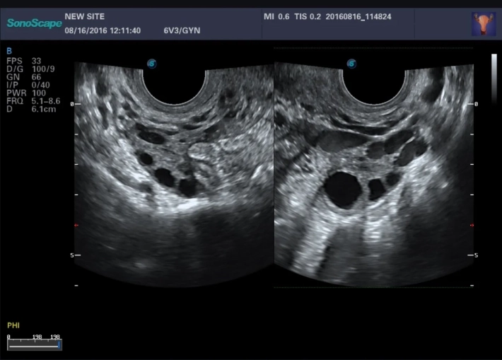 2. Яичник_result