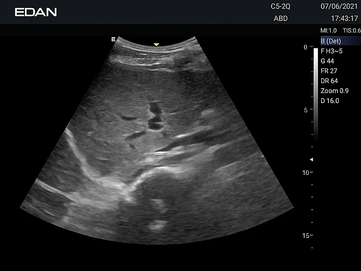 _20210706174321_0001_result