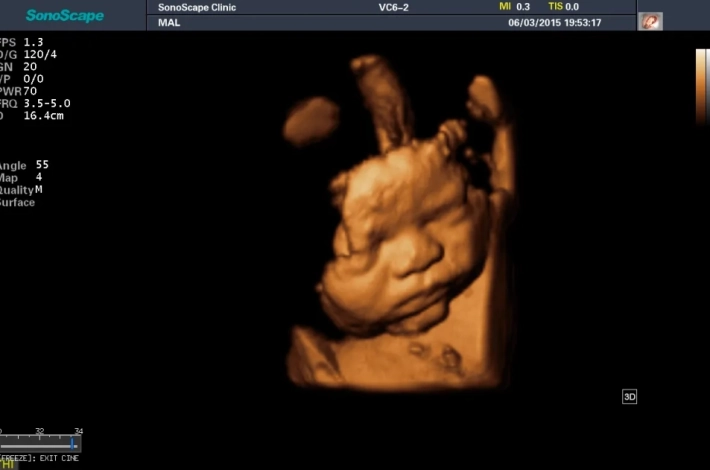 2. Лицо плода_3D_1_result