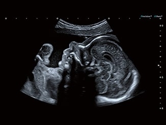 2eap68v00bq48r5yjgyhzp8zicqmxvus