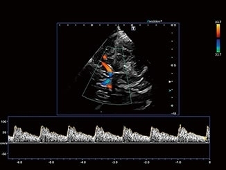 39xn7z47tn3mzbya2vwobkgiqpkigcr8