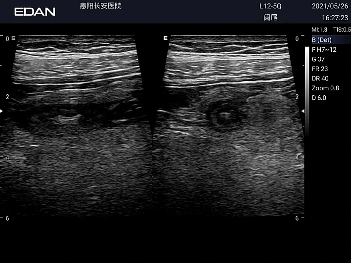 LX3 L12-5Q Appendix_20210526 (1)_result