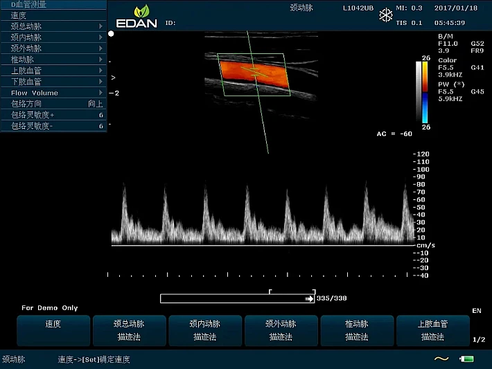 U60 L1042UB CCA (1)_result