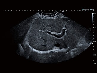 l8yok9pqejhg502cyp8tbl3kqw9e0yt6