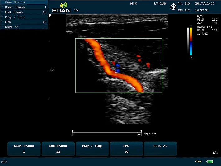 U60 L742 Vessel_result