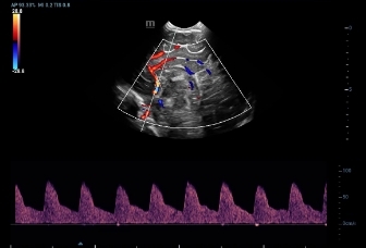 03-l9-3u-neonatal-brain-pw