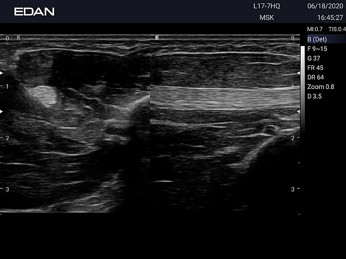 LX3 L17-7HQ Nerve_20200618_result