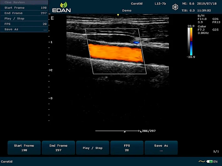 U60 L15-7b CCA (6)_result
