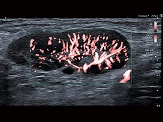 t91ipyezzvudp2yc043wepxh8ykssihr