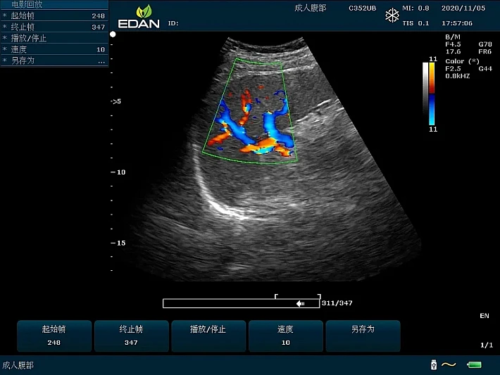 U60 C352UB Spleen(1)_result