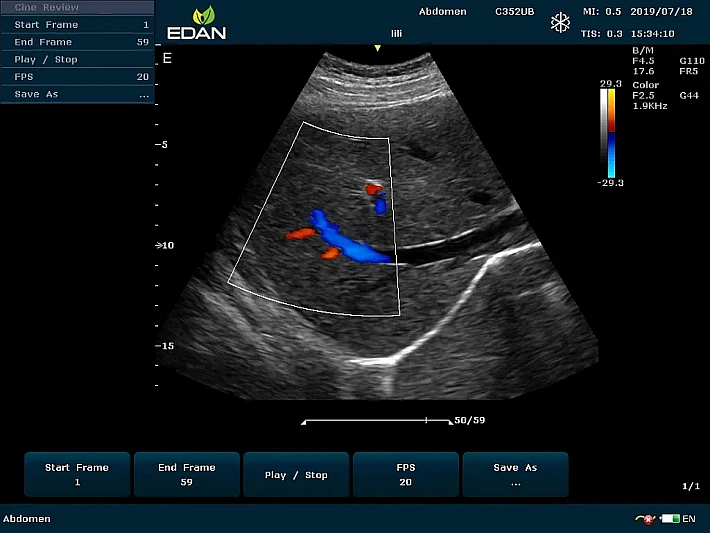 U60 C352UB liver (2)_result
