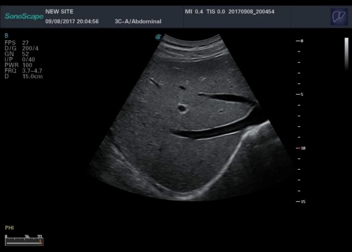 1. Печень_result
