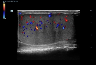 08-l14-6wu-testic-color