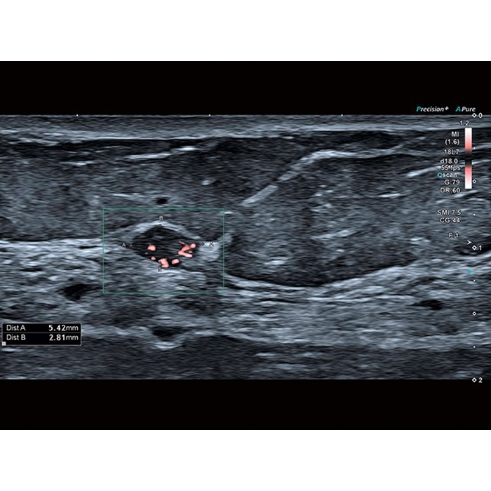 0043urzs6dxmyndgzeywyiql84khav68