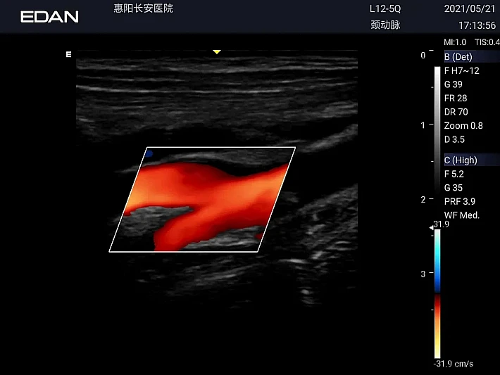 LX3 L12-5Q CCA_20210521_result
