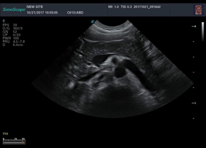 2. Поджелудочная железа_result