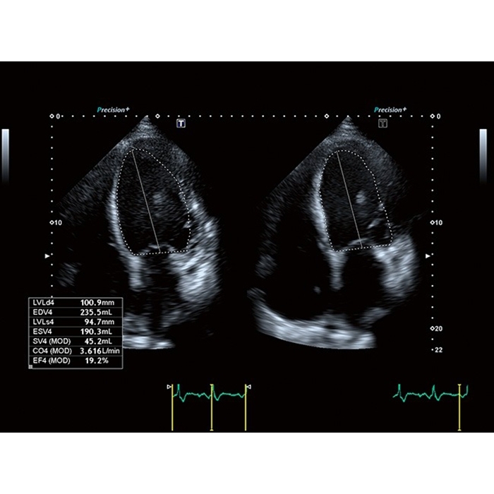 g1jsavd2m5dllon6cmfckc62j2msxz6v