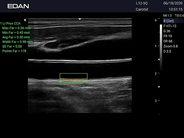 LX3 L12-5Q CCA_20200618 (3)_result