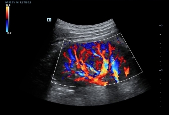 10-sc5-1-kidney-perfusion