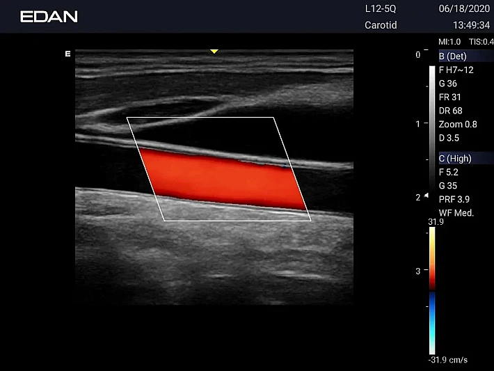 LX3 L12-5Q CCA_20200618 (2)_result