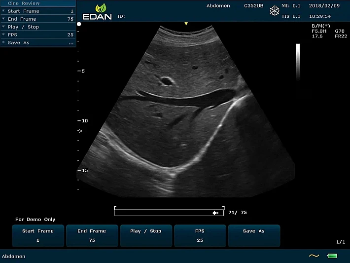 U60 C5-2b liver (1)_result