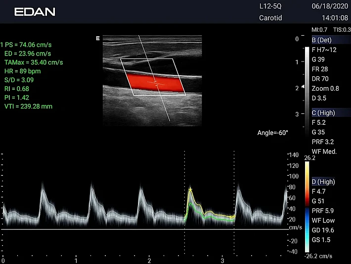 LX3 L12-5Q CCA_20200618 (1)_result