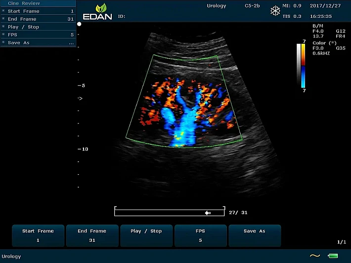 U60 C5-2b Kidney Colour_result