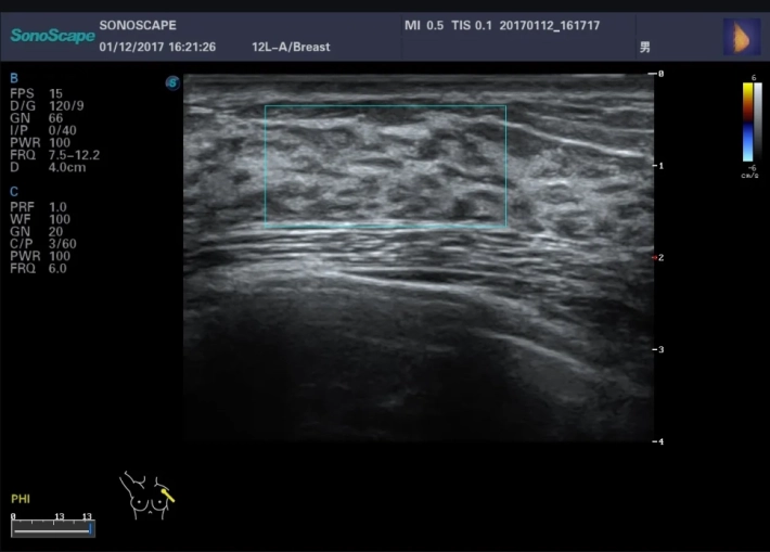 1. Молочная железа_result