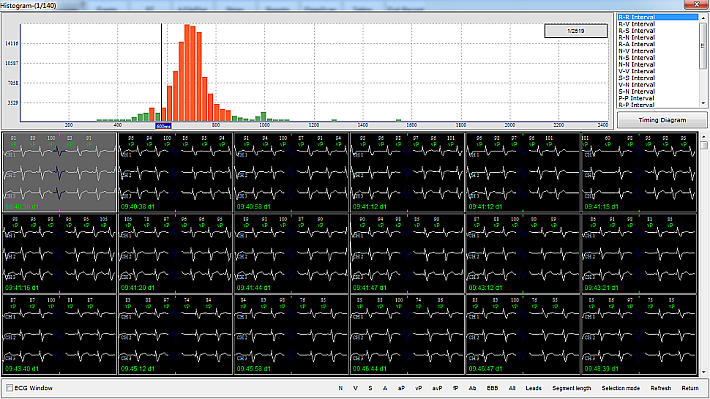 Histogram