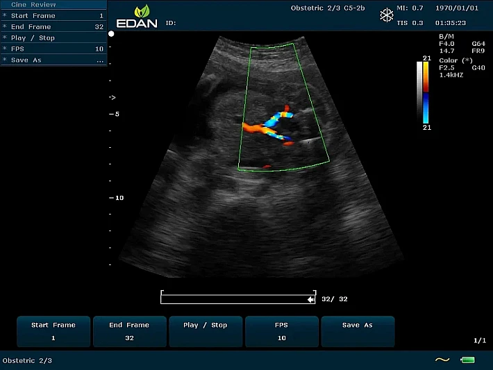 U60 C5-2b Fetus (4)_result