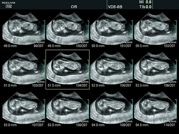 5vdoqnh3tixmp8rg3r15evq4zlt660nl