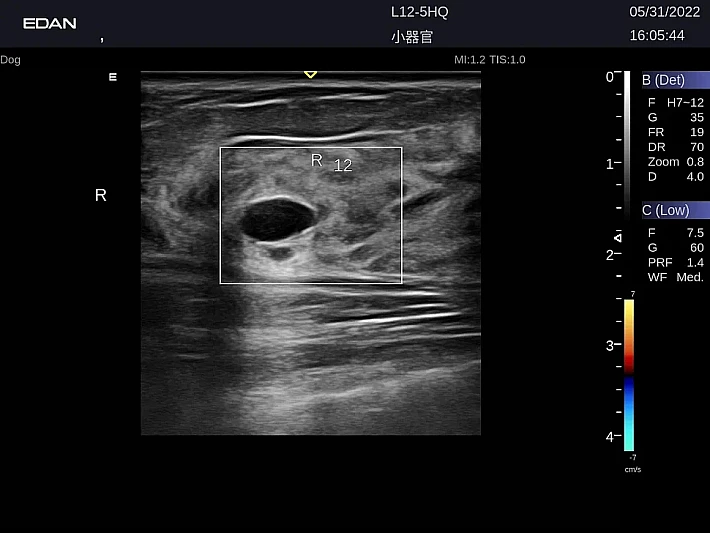 LX9 L12-5Q Breast_20220531 (2)_result