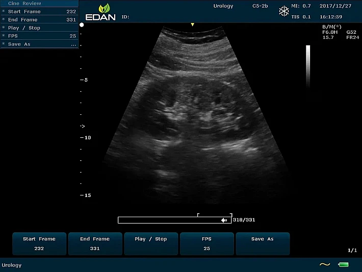 U60 C5-2b (1)_result