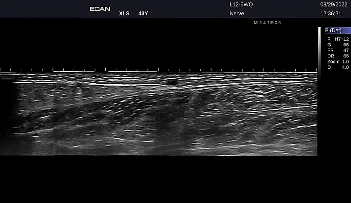 LX9 L12-5WQ Nerve_20220829 (4)_result