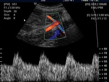 ijzri33jti3obhd4ofw6ykkf4kooug5k