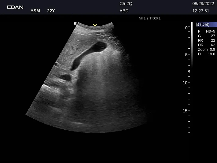 LX9 C5-2Q ABD_20220829 (1)_result