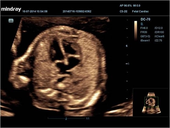 mindray-dc-70-pro-x-insight_2