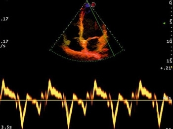 l0gzuj3fu4012wee3vg1giqwyzti1pqa