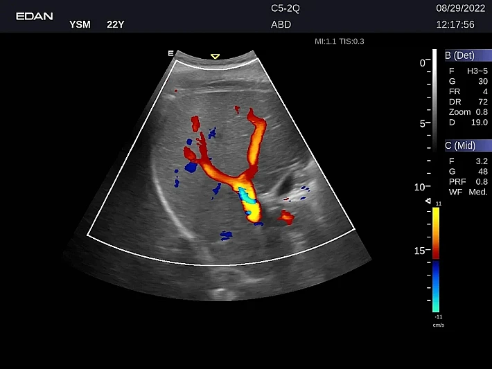 LX9 C5-2Q ABD_20220829 (6)_result