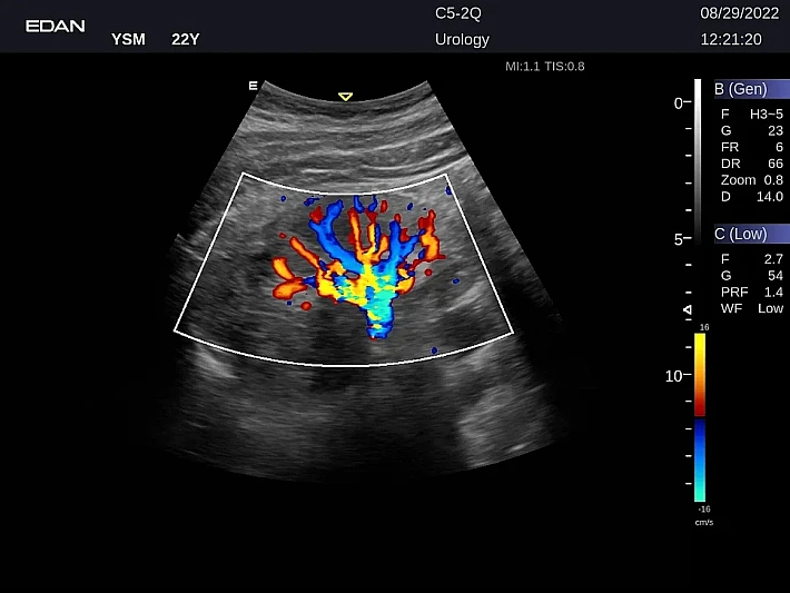 LX9 C5-2Q Kidney_20220829 (1)_result