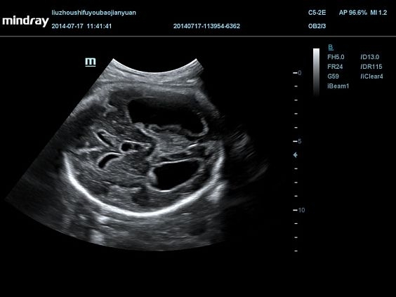 mindray-dc-70-pro-x-insight_3