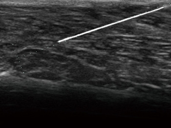 rvfodulp9un3515vppqr7aujxy5naobd