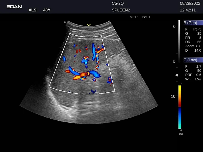 LX9 C5-2Q Spleen_20220829 (2)_result