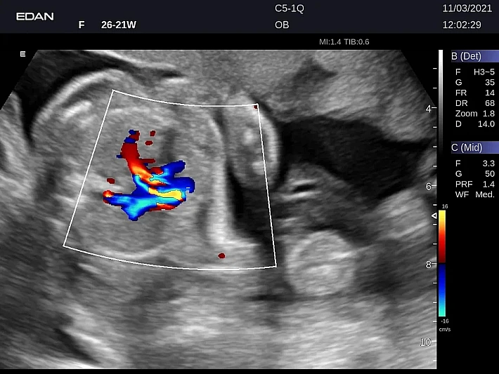 LX9 C5-1Q Ob_20211103 (16)_result