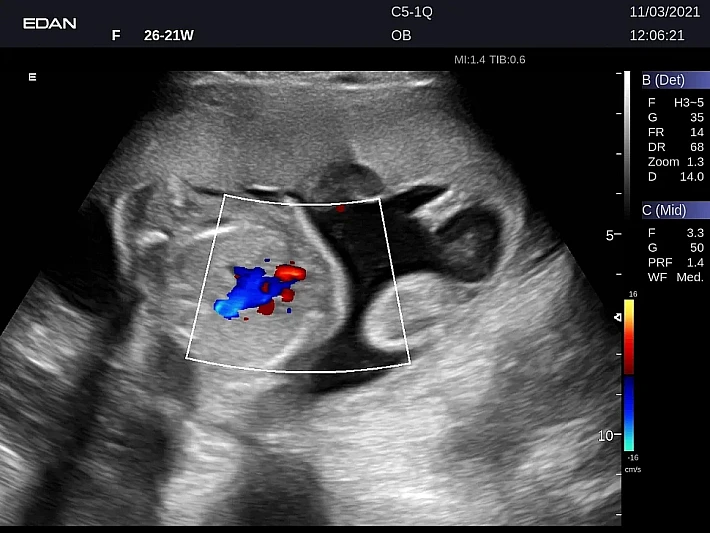 LX9 C5-1Q Ob_20211103 (4)_result