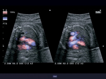 yj8ttqzfa6eyideyfov8ez2enb0ocydf