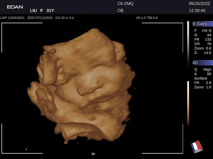 LX9 C6-2MQ OB_20220526 (15)_result