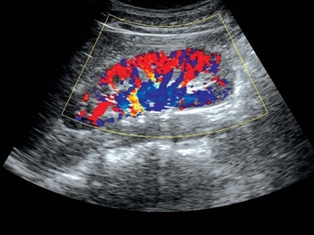 0xustkpo3ibywrv802k23h9d7xd6rdw1