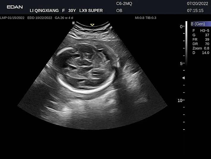 LX9 C6-2MQ OB_20220720 (10)_result