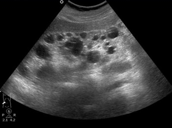 4cw4s1pp5a2fn6b2wly4358n2eqiiwm0